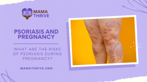 What are the Risks of Psoriasis During Pregnancy blog